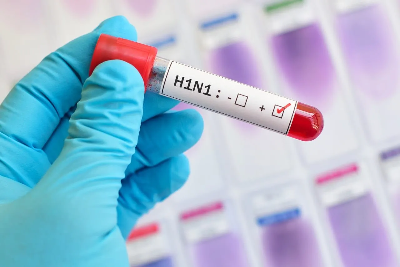 Пандемия свиного гриппа H1N1